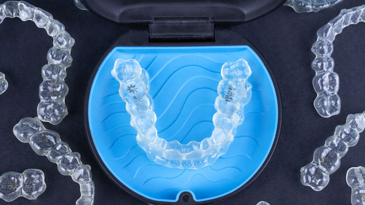 Unlocking the Benefits of Invisalign Treatment in Macleod